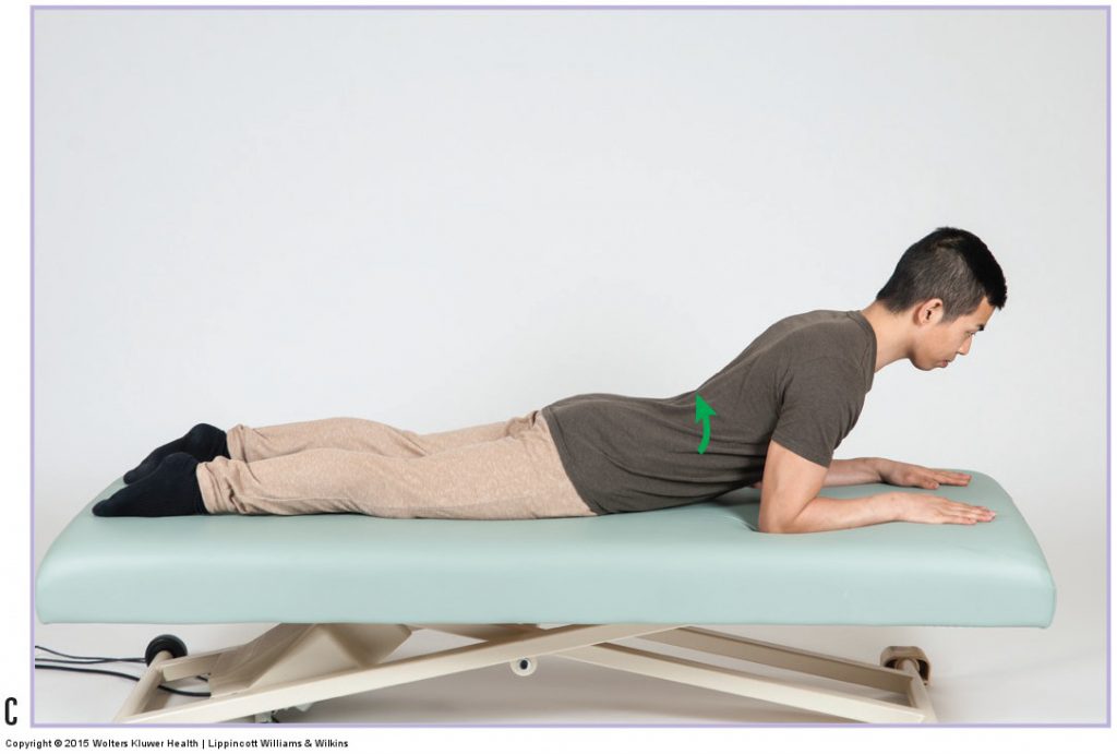 درمان بیرون زدگی دیسک کمر در کرج